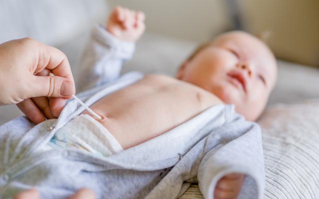 Hernia umbilical Bebé