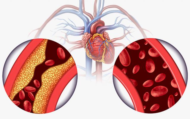Inhibidores de ECA para la tensión arterial